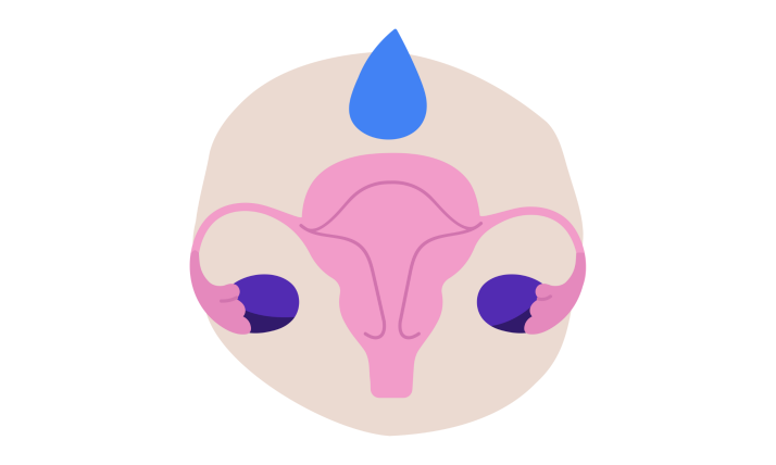 Hyperaktivní močový měchýř